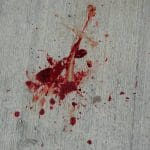 Teen Stabbed In UK Days After Violent Belfast Attack